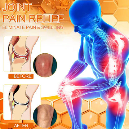 🇨🇦Official Store: flysmus™ Bee-Venom Pain-Relief Bone Healing Cream👨‍⚕️Healthy Canada Approved
