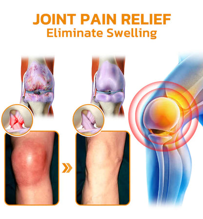 🇨🇦Official Store: flysmus™ Bee-Venom Pain-Relief Bone Healing Cream👨‍⚕️Healthy Canada Approved