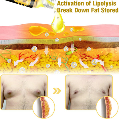 GFOUK™ Men-Therm Bee Venom Gynecomastia Heating Oil